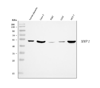 Anti-MMP1 Antibody