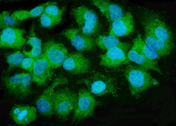 Anti-MTTP Antibody