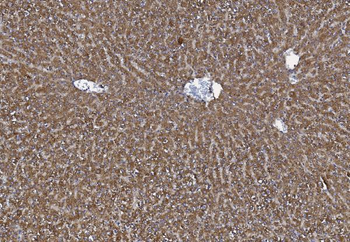 Anti-MTTP Antibody
