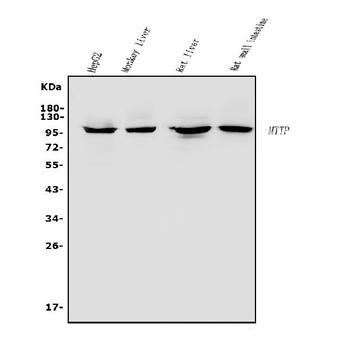 Anti-MTTP Antibody