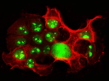 Nucleolin/NCL Antibody