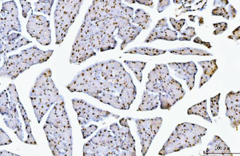 Nucleolin/NCL Antibody