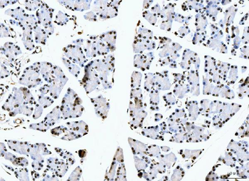Nucleolin/NCL Antibody