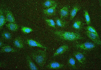 Anti-NF2/Merlin Antibody