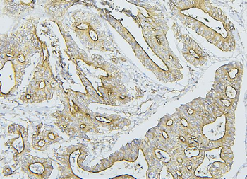 Anti-NF2/Merlin Antibody