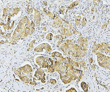 Anti-NF2/Merlin Antibody