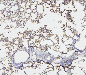 Anti-NF2/Merlin Antibody