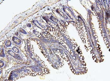 Anti-NF2/Merlin Antibody