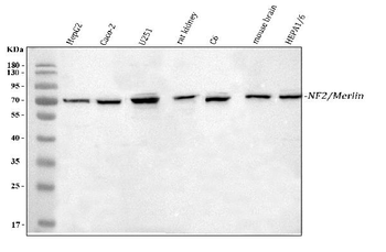 Anti-NF2/Merlin Antibody