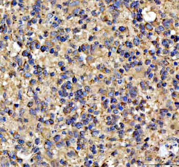 Anti-NOTCH2 Antibody