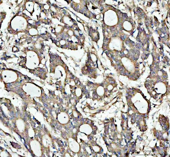 Anti-NOTCH2 Antibody