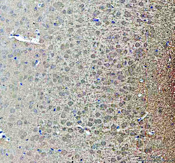 Anti-NOTCH2 Antibody