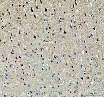 Anti-NOTCH2 Antibody
