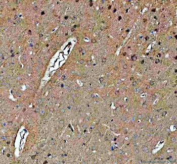 Anti-NOTCH2 Antibody