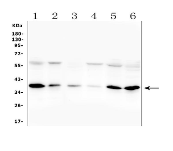 Anti-Orai1 Antibody