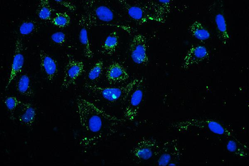 Anti-PKC delta/PRKCD Antibody