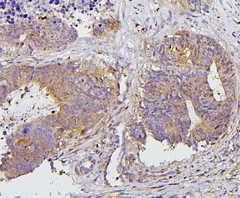 Anti-PKC delta/PRKCD Antibody