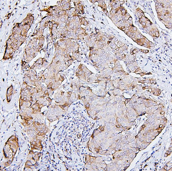 Anti-PKC delta/PRKCD Antibody