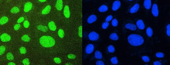 Anti-PTBP1 Antibody