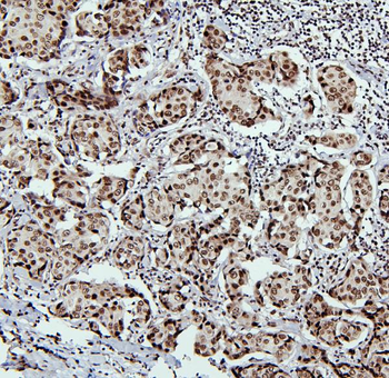 Anti-PTBP1 Antibody