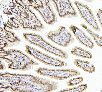 Anti-PTBP1 Antibody