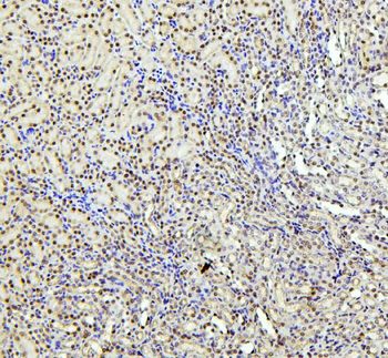 Anti-PTBP1 Antibody