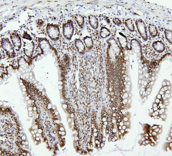 Anti-PTBP1 Antibody