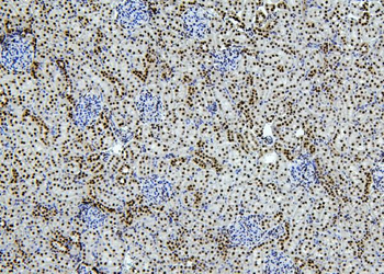 Anti-PTBP1 Antibody