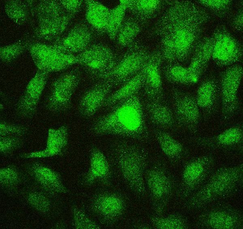 Anti-PTBP2 Antibody