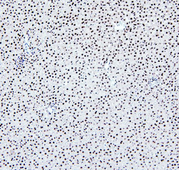 Anti-PTBP2 Antibody
