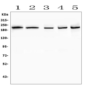 Anti-SMARCA2/BRM Antibody