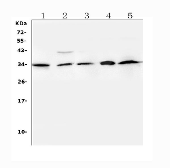 Anti-BAFF/TNFSF13B Antibody