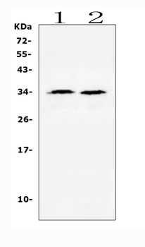Anti-BAFF/TNFSF13B Antibody