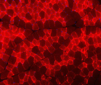 Anti-Troponin I fast skeletal muscle/TNNI2 Antibody