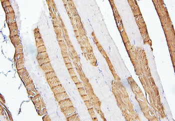 Anti-Troponin I fast skeletal muscle/TNNI2 Antibody