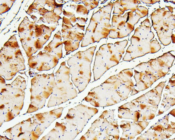 Anti-Troponin I fast skeletal muscle/TNNI2 Antibody