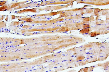 Anti-Troponin I fast skeletal muscle/TNNI2 Antibody