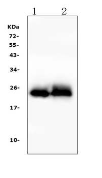 Anti-Troponin I fast skeletal muscle/TNNI2 Antibody