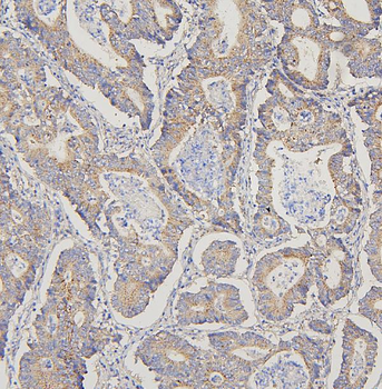 TRPV3 Antibody