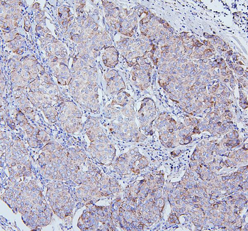 TRPV3 Antibody