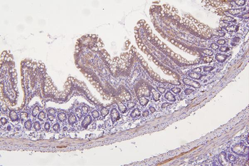 Anti-Thioredoxin 2/TXN2 Antibody