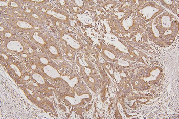 Anti-Thioredoxin 2/TXN2 Antibody