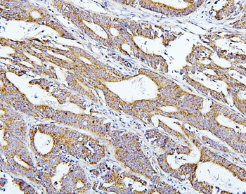 Anti-Thioredoxin 2/TXN2 Antibody