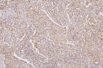 Anti-Thioredoxin 2/TXN2 Antibody