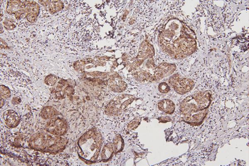Anti-Thioredoxin 2/TXN2 Antibody