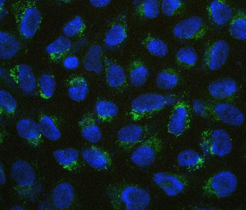Anti-B7H4/VTCN1 Antibody