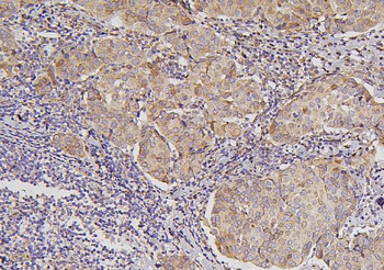 Anti-B7H4/VTCN1 Antibody