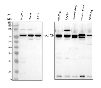 Anti-B7H4/VTCN1 Antibody