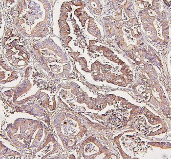 Anti-Aldolase/ALDOA Antibody