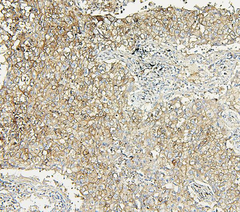 Anti-Aldolase/ALDOA Antibody